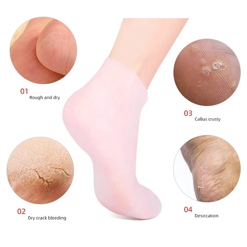Silicone Moisturizing Spa Gel Heel Socks